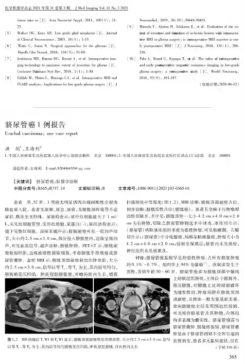 脐尿管癌1例报告