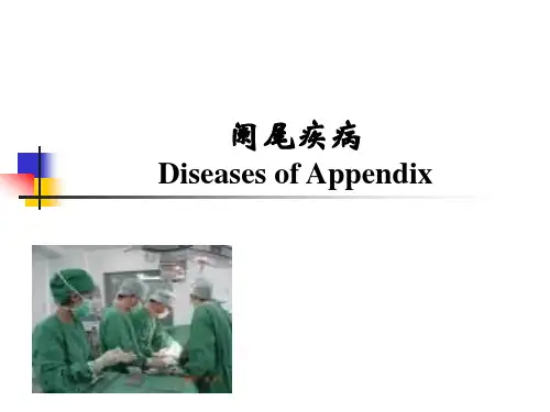 阑尾炎的诊断、鉴别诊断与治疗