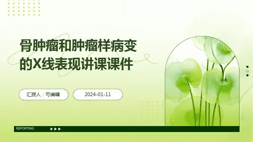 骨肿瘤和肿瘤样病变的X线表现讲课课件
