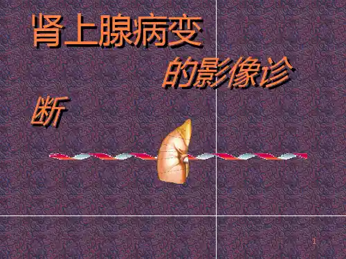 肾上腺病变的影像诊断ppt课件