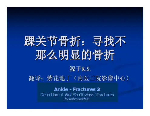 踝关节骨折：寻找不那么明显的骨折