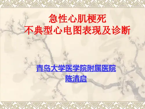 急性心肌梗死不典型心电图表现