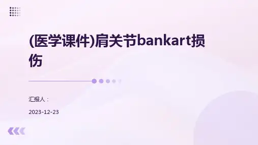 (医学课件)肩关节bankart损伤