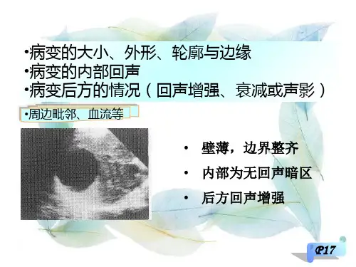最新超声学-五年制腹部-PPT文档