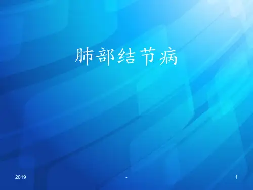 肺部结节病ppt课件