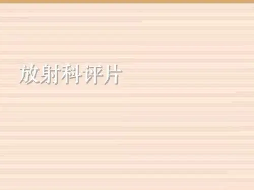 鼻腔及鼻窦恶性黑色素瘤  ppt课件