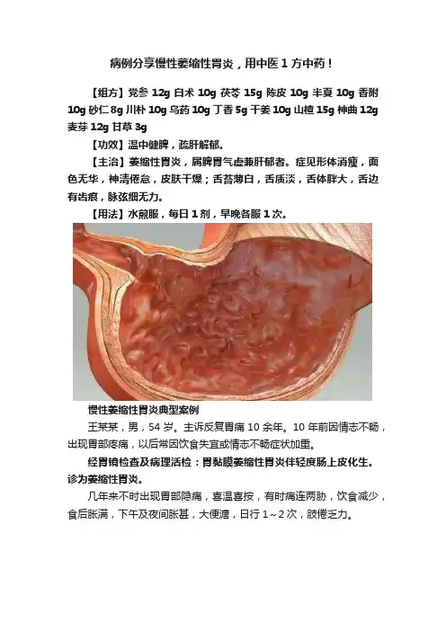 病例分享慢性萎缩性胃炎，用中医1方中药！