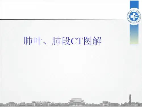 肺叶、肺段ct图解