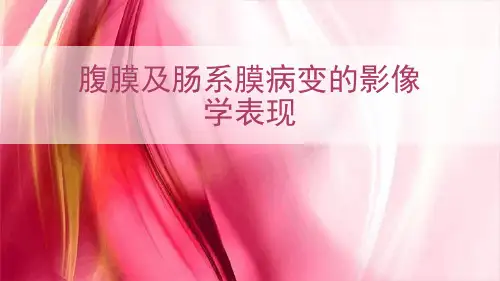 完整版腹膜病变影像诊断及鉴别诊断