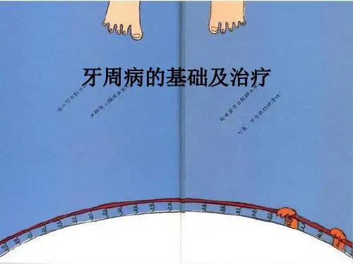 牙周病的基础及治疗ppt课件