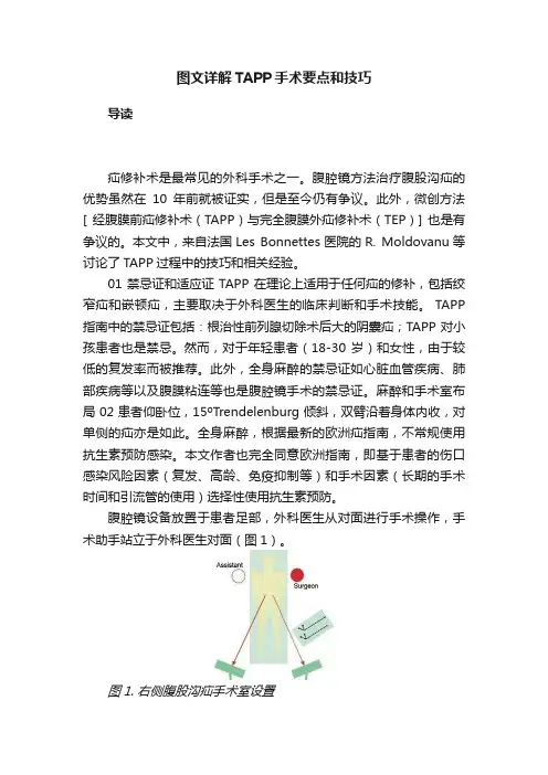 图文详解TAPP手术要点和技巧
