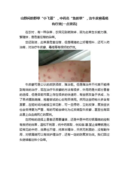 山野间的野草“小飞蓬”，中药名“鱼胆草”，治牛皮癣毒疮有疗效[一点资讯]