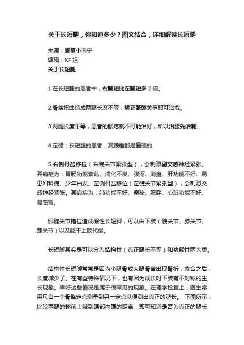 关于长短腿，你知道多少？图文结合，详细解读长短腿