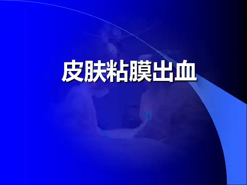 皮肤粘膜出血