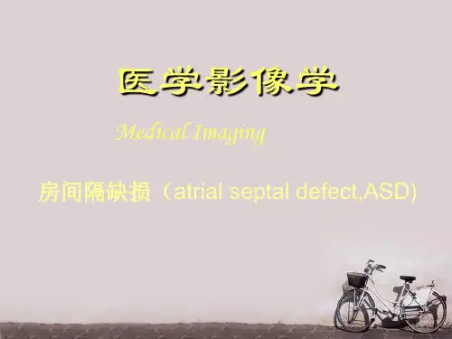 医学影像学--房间隔缺损  PPT课件