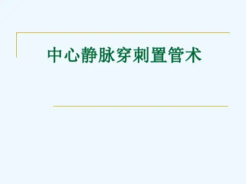 中心静脉穿刺置管