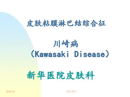 川崎病