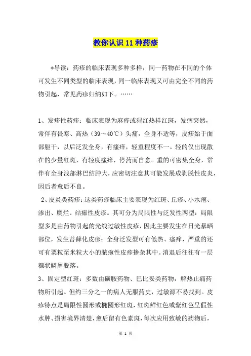 教你认识11种药疹