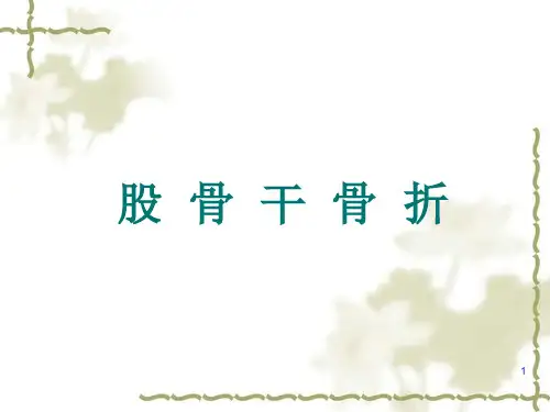 股骨骨折 ppt课件