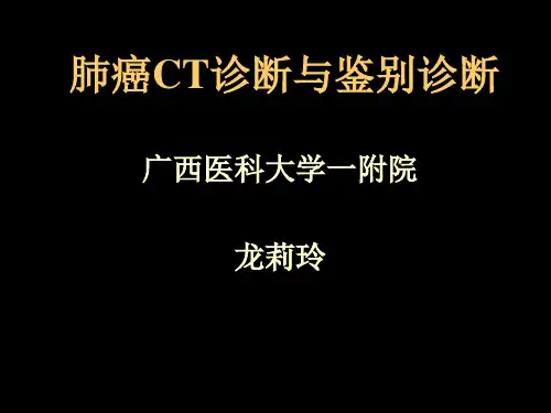 肺癌CT诊断与鉴别诊断模板