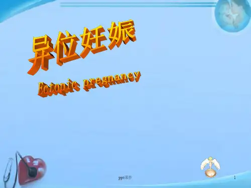 异位妊娠 (4)  ppt课件