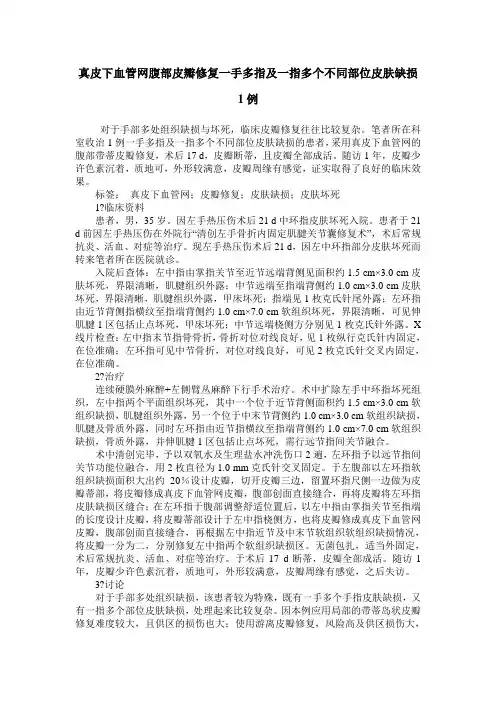 真皮下血管网腹部皮瓣修复一手多指及一指多个不同部位皮肤缺损1例