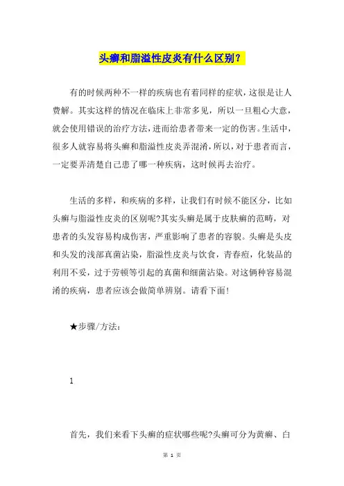 头癣和脂溢性皮炎有什么区别？