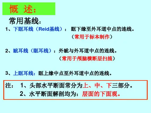 断解：脑水平切4