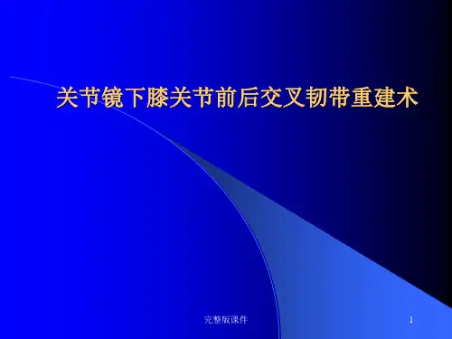 关节镜下膝前后交叉韧带重建术ppt课件