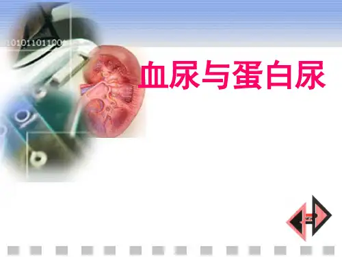 血尿与蛋白尿ppt课件