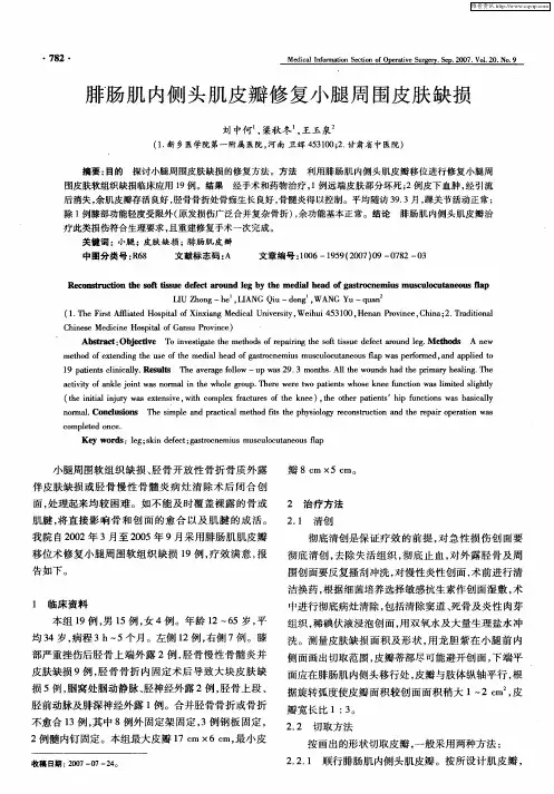 腓肠肌内侧头肌皮瓣修复小腿周围皮肤缺损