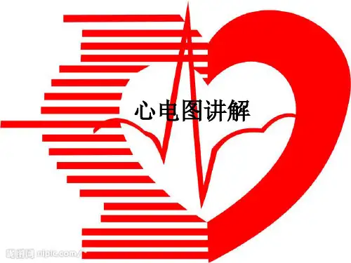 心电图讲解