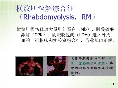 横纹肌溶解综合征PPT幻灯片课件