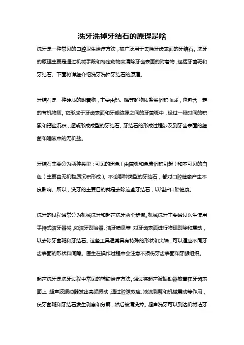 洗牙洗掉牙结石的原理是啥