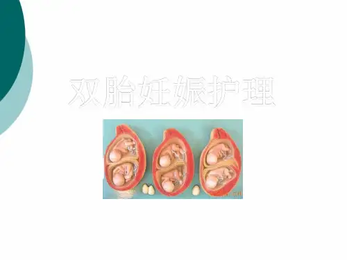 双胎妊娠护理PPT课件