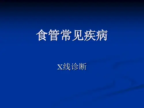 医学影像学课件食管疾病