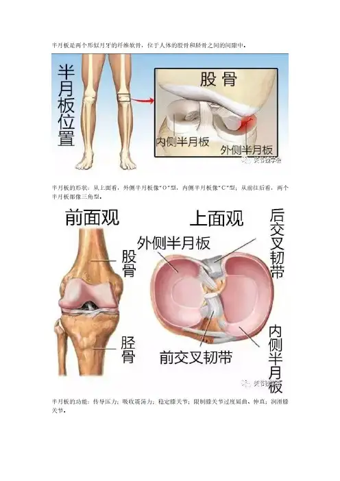 半月板的损伤及治疗