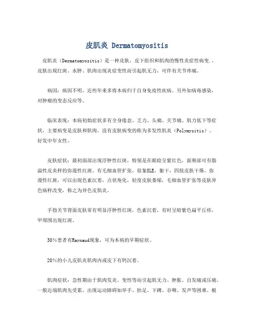 皮肌炎 Dermatomyositis