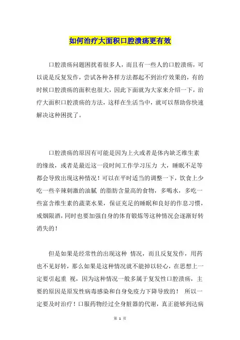 如何治疗大面积口腔溃疡更有效