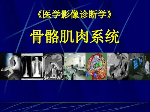《医学影像诊断学》慢性关节病脊柱病变软组织病变PPT