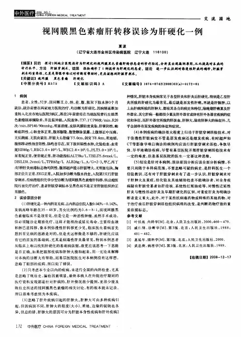 视网膜黑色素瘤肝转移误诊为肝硬化一例