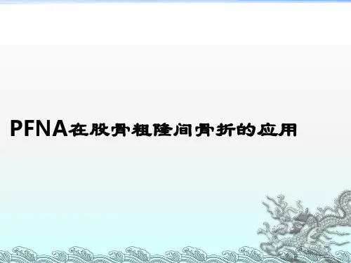 PFNA在股骨粗隆间骨折的应用ppt课件