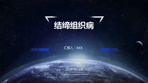结缔组织病演示ppt课件