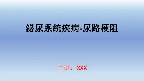 尿路梗阻