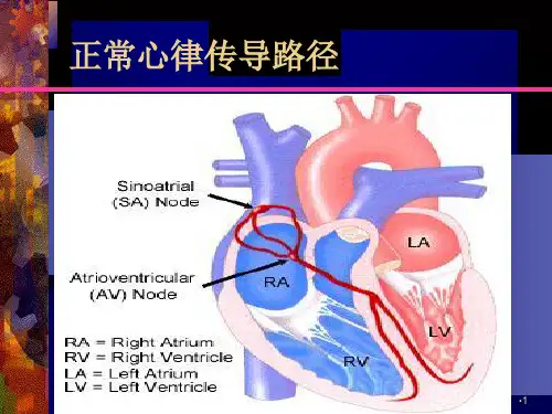 心律失常药物治疗参考PPT