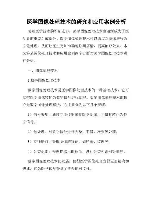 医学图像处理技术的研究和应用案例分析