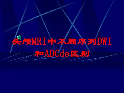 头颅MRI中不同序列DWI和ADC的区别培训课件