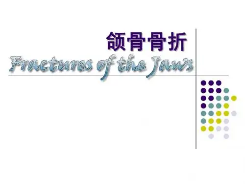 口腔颌面外科颌骨骨折ppt课件