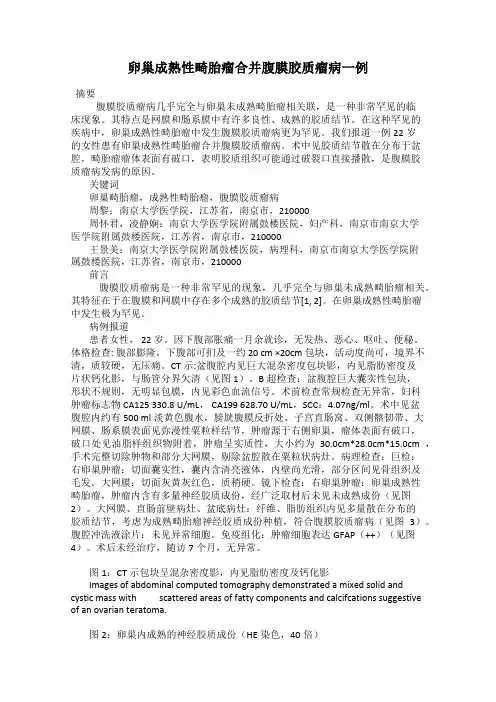 卵巢成熟性畸胎瘤合并腹膜胶质瘤病一例