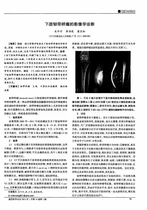 下肢韧带样瘤的影像学诊断